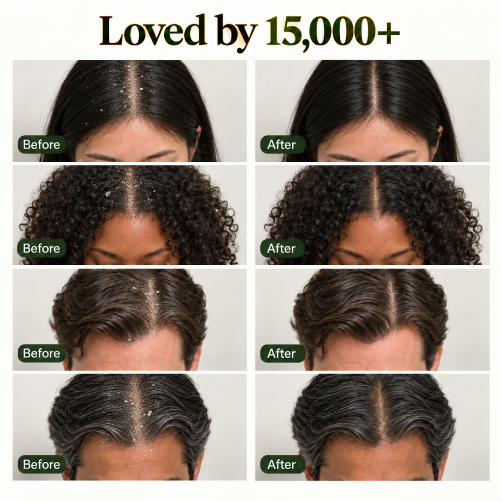 BINURA™ Anti Dandruff Shampoo Bar