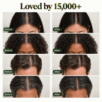 BINURA™ Anti Dandruff Shampoo Bar